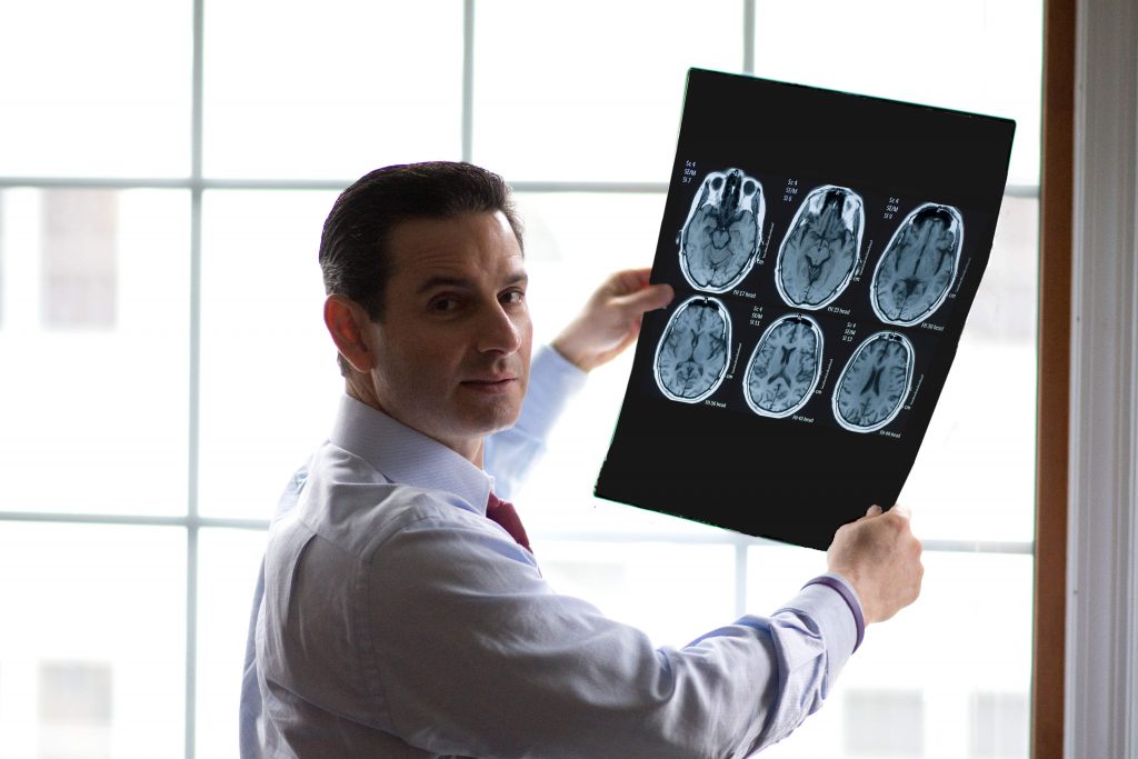 Common Causes of Traumatic Brain Injuries