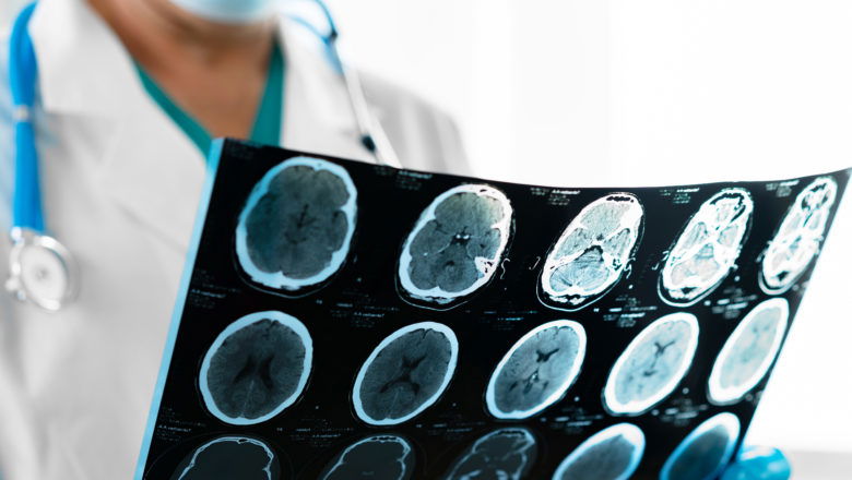 The figures relating to traumatic brain injury (TBI) in New Jersey and the nation are alarming.